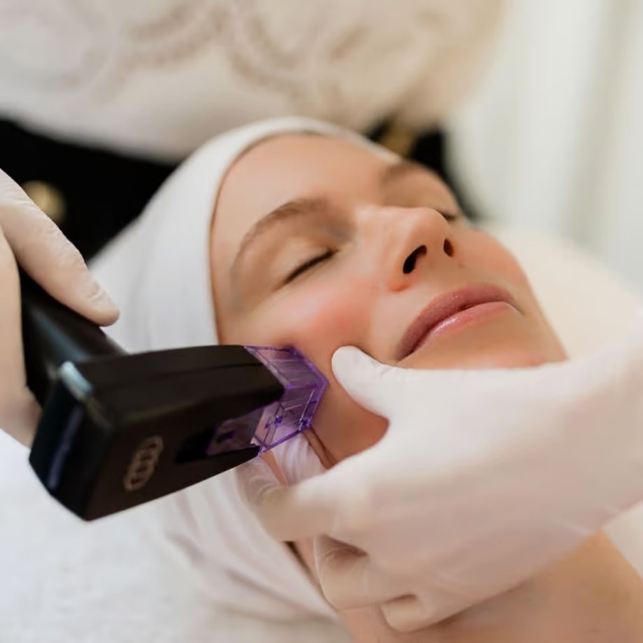 Laser Skin Treatments